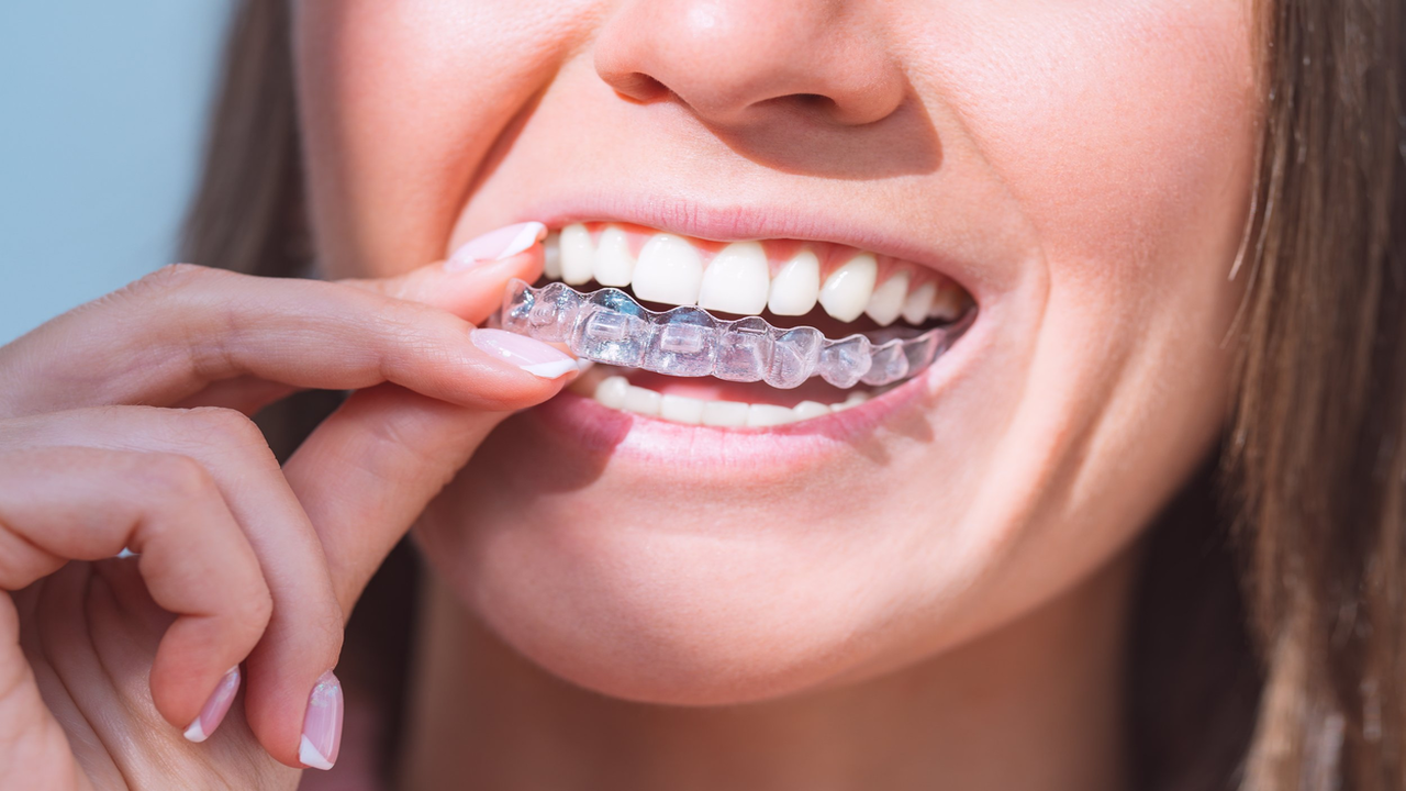 Dental Implants vs. Dentures: Which is Right for You?