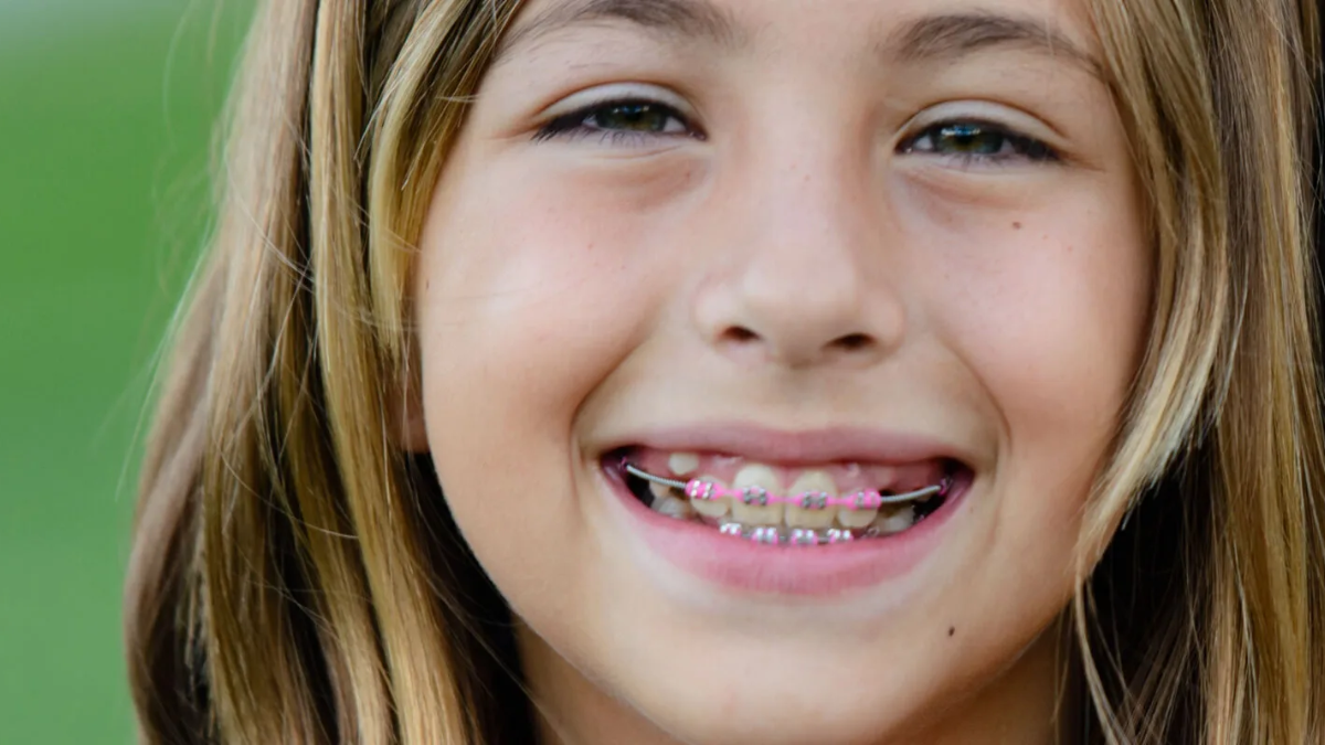 Can you get braces with a missing tooth 