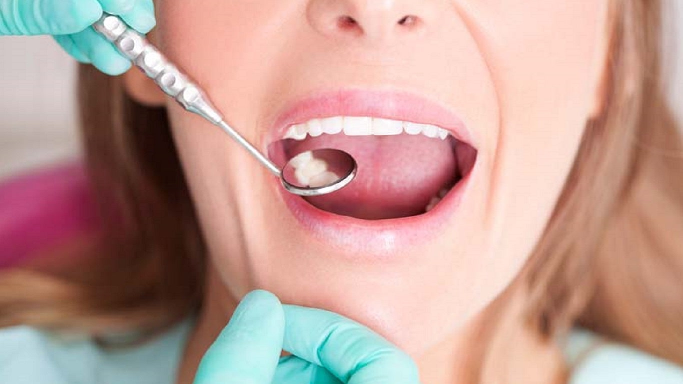 What are signs of poor oral hygiene?  