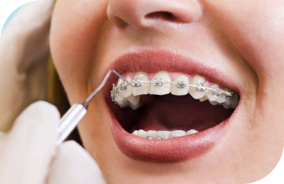 Orthodontics 